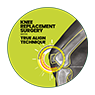 Knee Joint Replacement Surgery